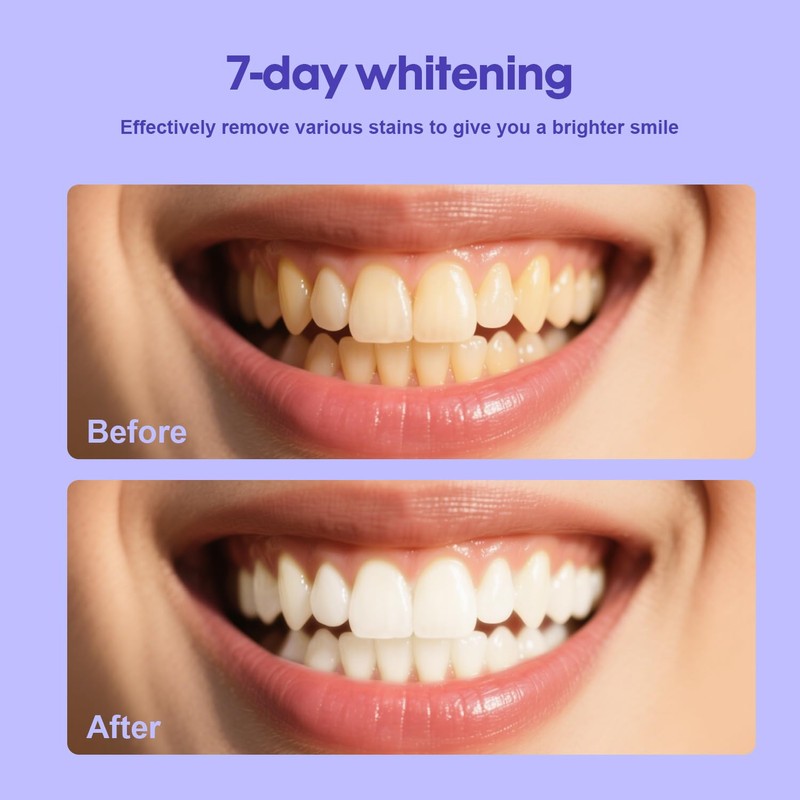 SarCop Teeth Whitening Powder - Enamel-Safe & Sensitivity-Free Natural Tooth