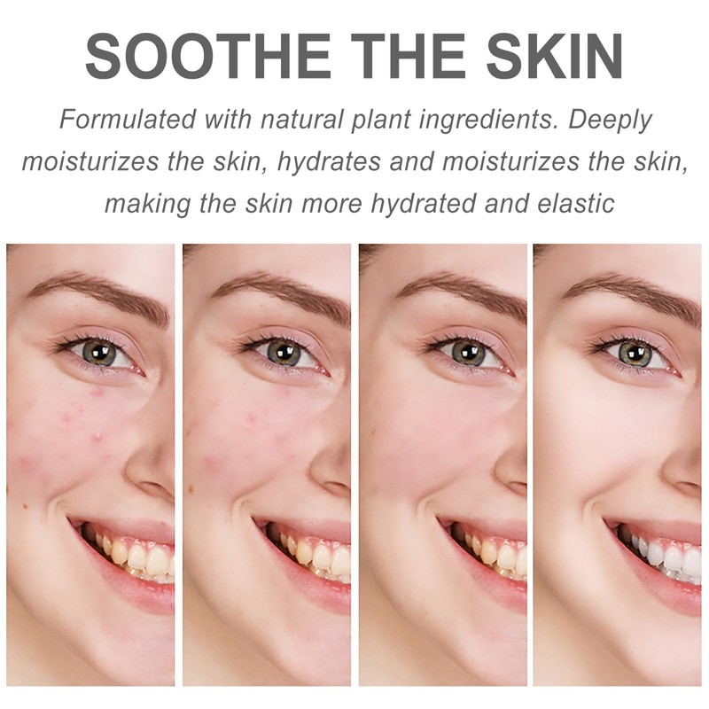 2 Stück Centella Calming Gel Cream, Beruhigende Creme, Day&Night Cream,