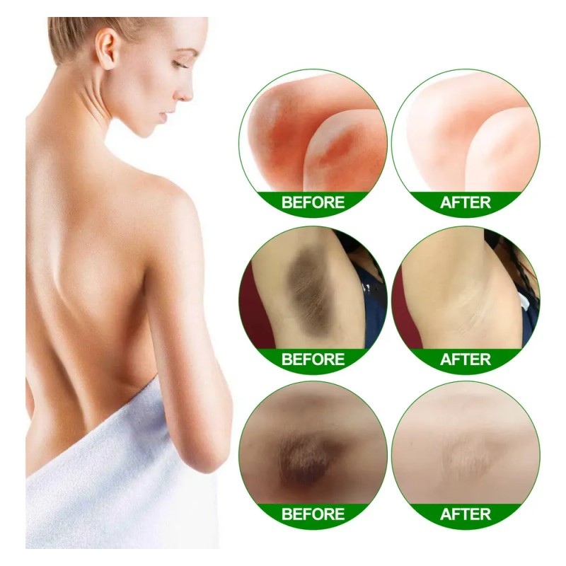 Crema Corporal Aclaradora De Piel Eelhoe Para Codos Y Axilas