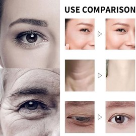 Crema Anti - Arrugas Qingling Japonesa, Crema Anti - Arrugas Qingling, Crema Anti - Arrugas Polipéptidos Qingling, Crema De Cuidado Hidratante Facial Qingling, Adecuada Para Toda La Piel (2pcs)