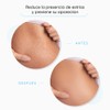 Stretch Mark Cream, 500 ml | Anti-Stretch Marks Body Cream,