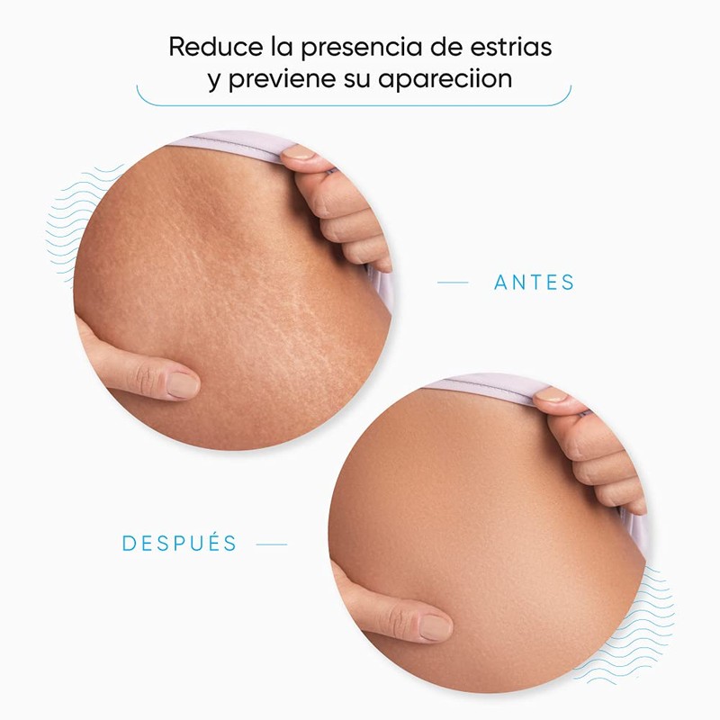 Stretch Mark Cream, 500 ml | Anti-Stretch Marks Body Cream,