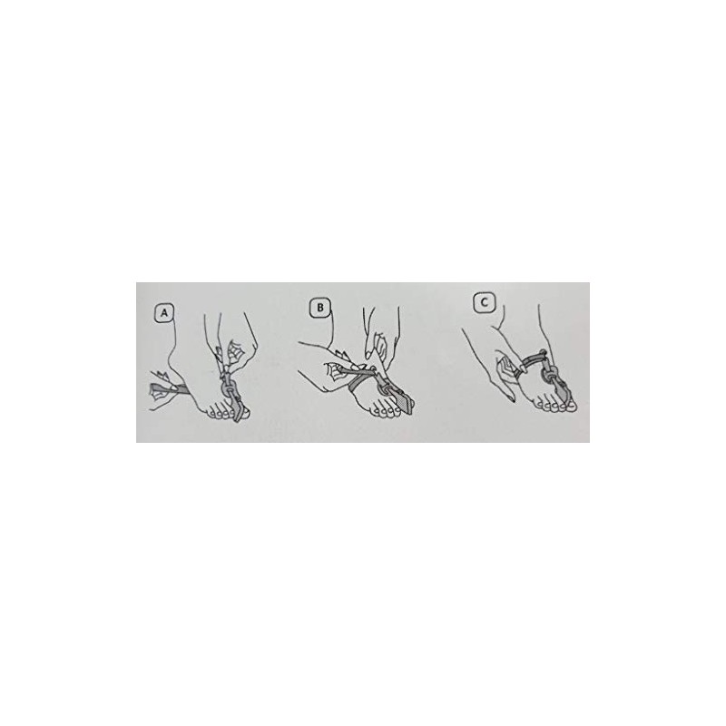Russka Hallux Valgus Night Splint for Correction of Big Toe