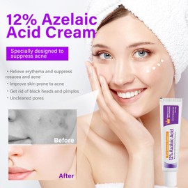 12% Acid Spot Cream - Acne Treatment for Spot Prone Skin -Face Serum Hyaluronic Acid For Redness, Dark Spots - Oil-Free Face Serum for Women -Pigmentation Treatment for All Skin Types