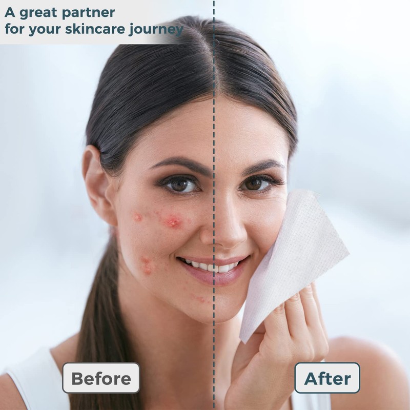Ourmed Life Disposable Face Towel | 100 Count Lint-Free Biodegradable