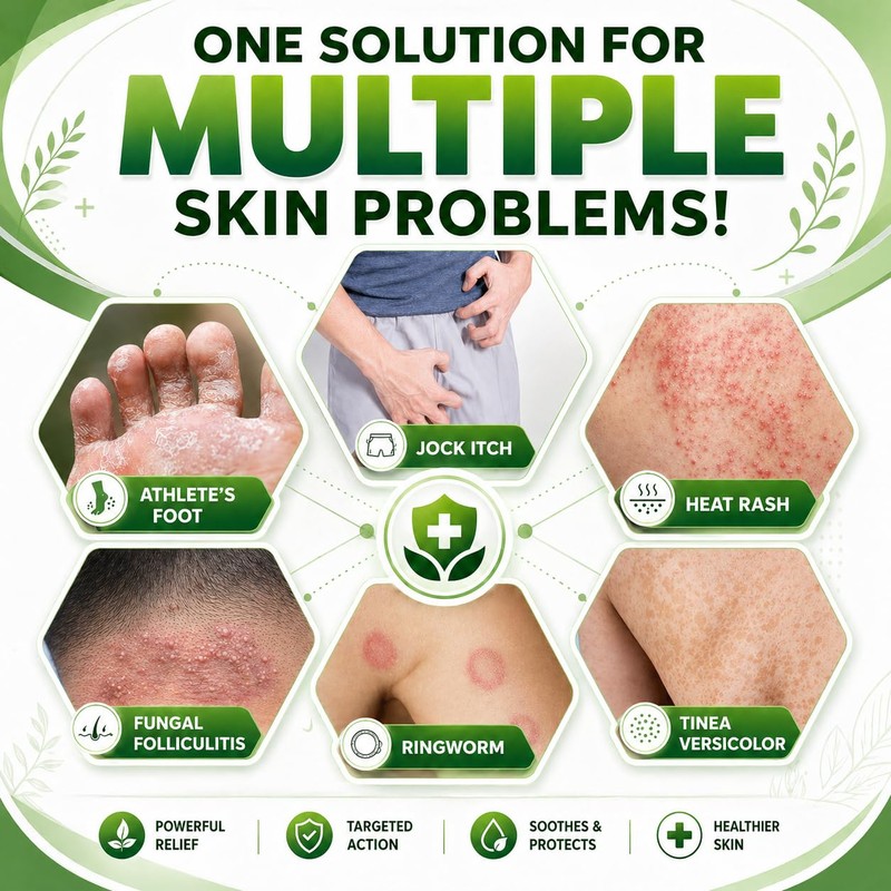 Tea Tree Oil Cream for Fungal-Prone Skin – Suitable for