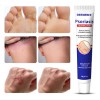 Crema De Tratamiento Psoriasis Para Picazón Y Escamosa