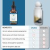 Native Remedies Sweat-Less - Natural Homeopathic Formula for Excessive Sweating,