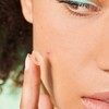 Iroha Nature - Pimple Plasters with Salicylic Acid, Tea Tree