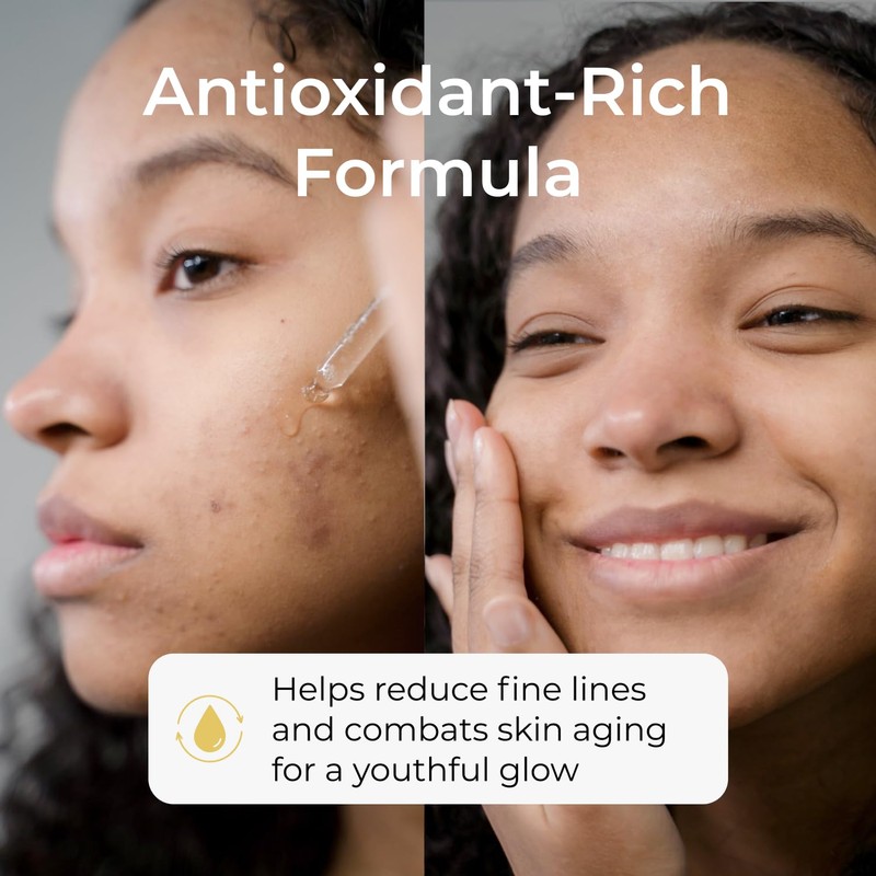 NIACINAMIDE 10% + ZINC 1% SERUM for large pores and