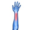 Soles SLS510L Wrist Splint with Thumb Stabiliser