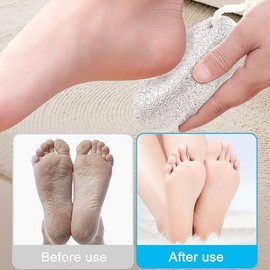 2 Pack Pumice Stone for Feet/Hands/Body, Natural Lava Pumice Stone for Dead Hard Skin Removal, Foot Scrubber, White Callus Remover, Foot File for Men/Women for Exfoliation(Grey)