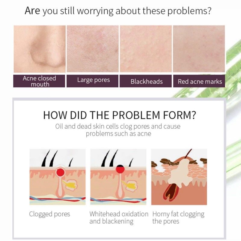 AHA 30% + BHA 2% Peeling Solution, Chemical Peel for