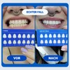 Professional Sensitive Teeth Whitening Strips - 28 Strips without Peroxide