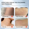 Strawberry Legs Treatment,Keratosis Pilaris Treatment,Skin Exfoliating Repair Lotion,Keratosis Pilaris Cream,Moisturizing