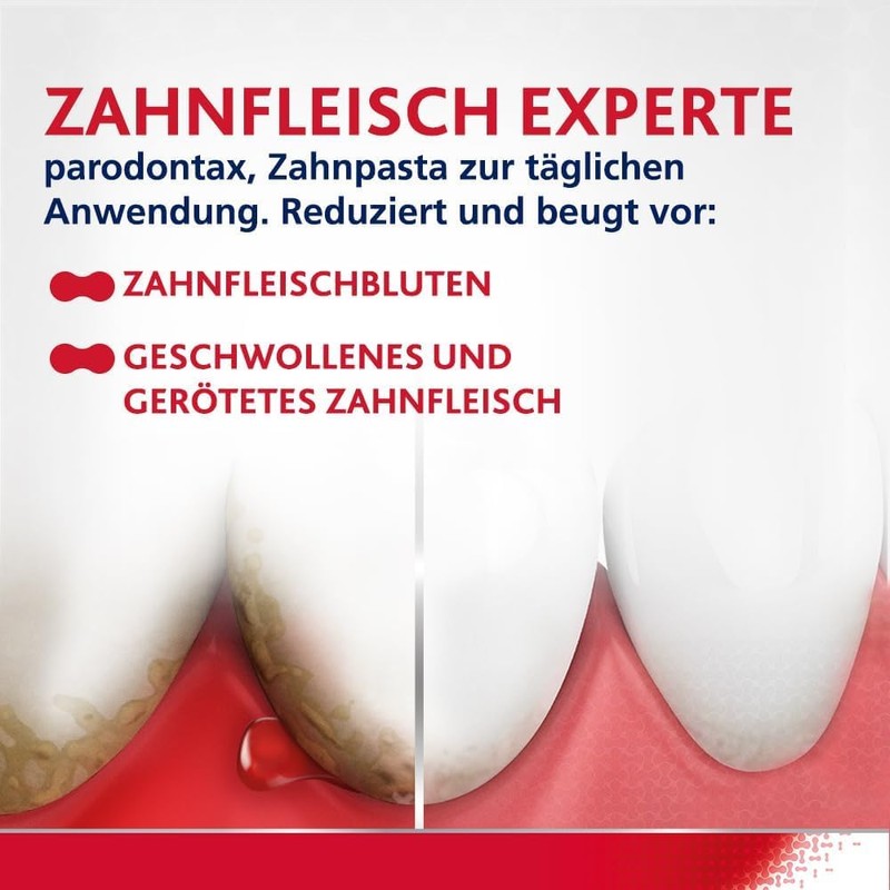 Parodontax Ultra Clean 75 ml, helps reduce and prevent bleeding