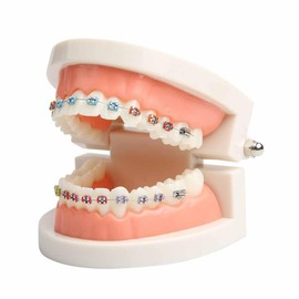 Dental Orthodontic Teeth Model with Braces Denture Mouth Model for Dentistry