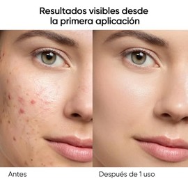 Skintific Mascarilla Facial en Barra de Mugwort para Limpieza Profunda, Stick de Arcilla Purificante con Mugwort para Puntos Negros, Skin Care Coreano
