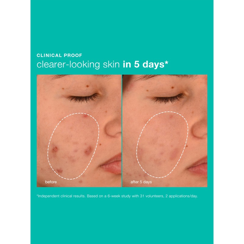 Dermalogica Breakout Biotic Moisturiser 50ml