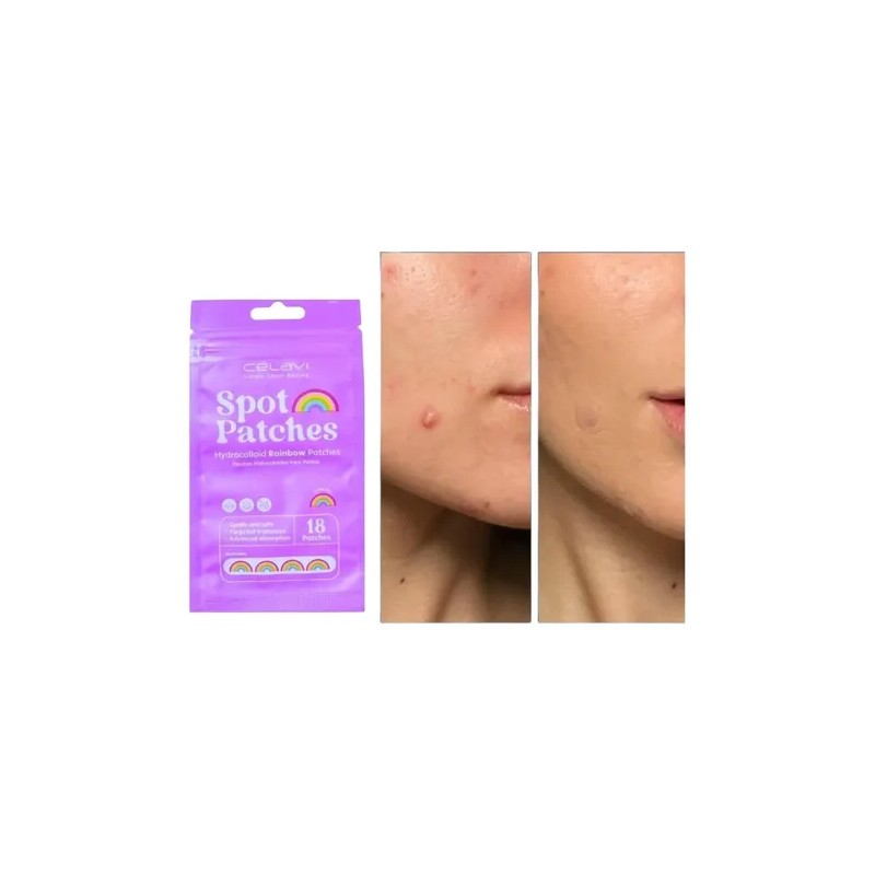 Parches Acne 36pz Arcoiris Dia Noche Hidrocoloide Celavi
