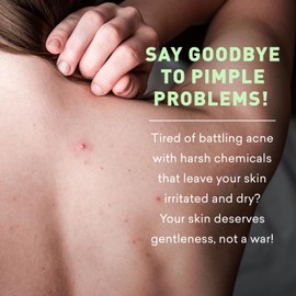 Just Nutritive Acne Clear Face and Body Wash | Adult Acne Treatment | Acne Face Wash | Face Skin Care | Back Acne Treatment | Acne Cleansers 16 Oz