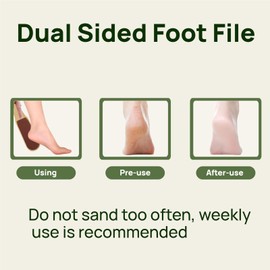 2 Pack Dual Sided Foot File Callus Remover Professional Foot File Pedicure Tool with Dead Skin Remover Scrubber,Non-Slip for Home Use