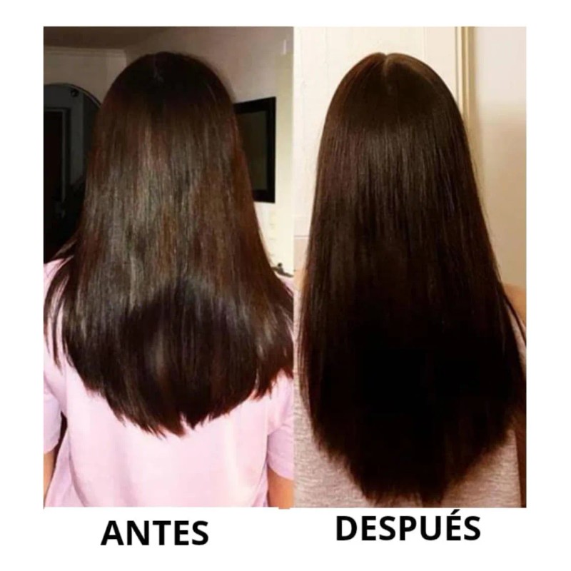 Tres Shampoo Cola Caballo Xiomara Crecimiento Reparación