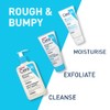 CeraVe SA Renewing Foot Cream for Extremely Dry, Rough, and