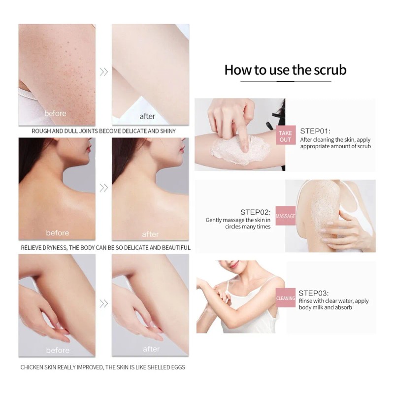 Exfoliante Facial Corporal Hidratante Aclara Manchas 350ml