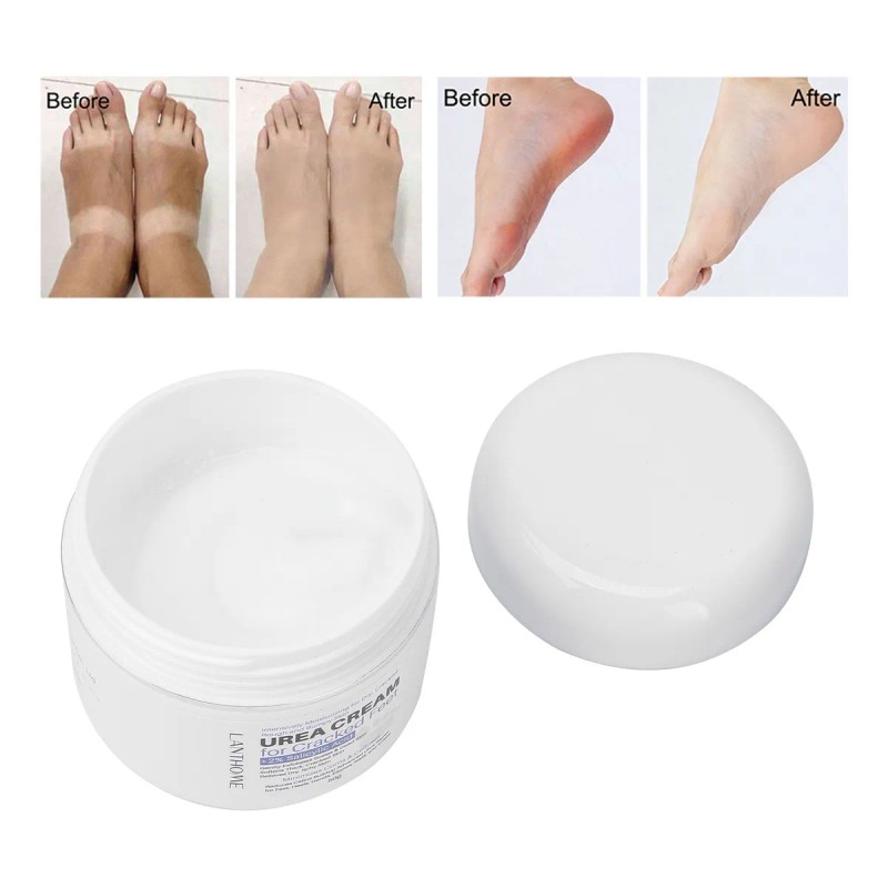 Lanthome Crema De Urea Crema Removedora De Callos De Pies