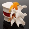 APHRODITE Spine Model, 1:1.5 Size, Herniated Disc Model, Movable (White)