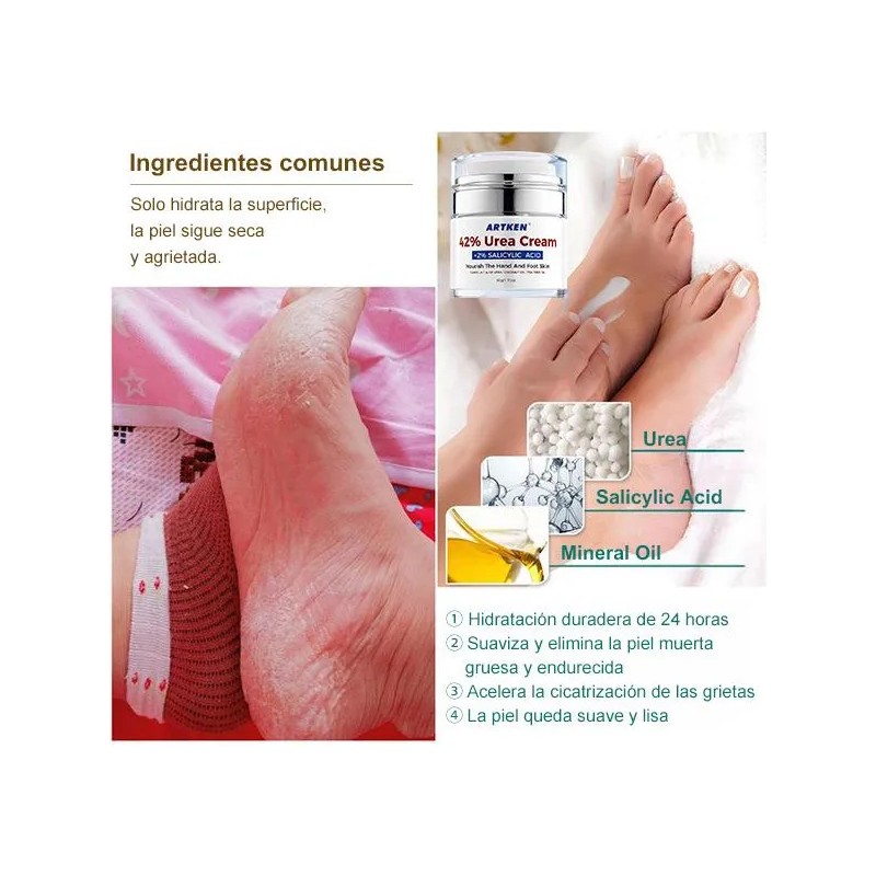 Artken Reparación Para Pies Agrietados Y Resecos - Crema T