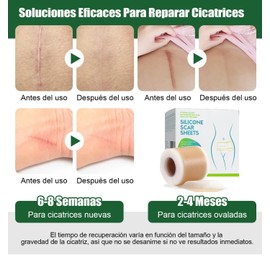 Premium Wundpflaster (5 Meter) – Narbenreduzierer – Professionelle medizinische Silikonfolien reduzieren und verhindern hypertrophe oder cheloide Narben, Verbrennungen und Schnitte