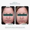 Marini SkinSolutions Rosalieve Redness Reducing Complex - Hidratante Facial con