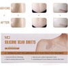 10PCS Silicone Scar Tape