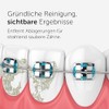 Wondersmile Periodontal Nozzle - Replacement Nozzles for Waterflow Oral Irrigator