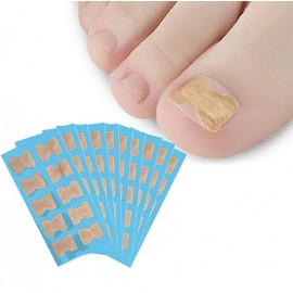 Ingrown Toenail Correction & Protection Strip: Self-Care Toenail Care Tape Band 4ea