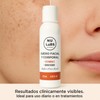 NU LABS Suero Facial y Corporal con Vitamina C Liposomada,