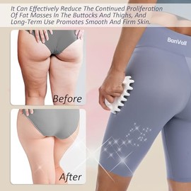 Fascia - Herramienta de masaje para masajeador de celulitis, libera el drenaje linfático, apriete la piel, reduce la celulitis, masajeador de puntos d
