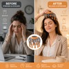 20-Head Scalp Massager for Relaxation – Vibration Head Scratcher with
