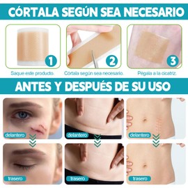 POGEPE Cinta de Silicona para Cicatrices, Cinta de Silicona para Eliminar Cicatrices de 4cm X 5m, Parches de Silicona para Cicatrices Elimina Cicatrices Antiguas y Nuevas, para Cesárea, Cirugía