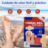 Parches Reparadores de Uñas+Tratamiento de Uñas con Esencia de Jengibre
