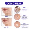 Parches Aliver Antiacné Pack 180 Unidades Día/noche Todo Tip