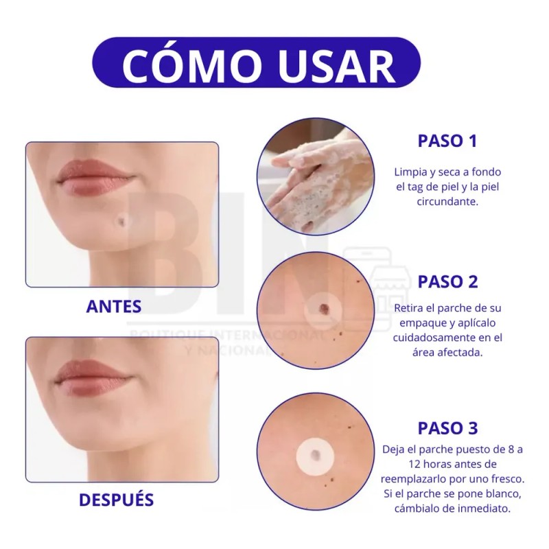Parches Aliver Antiacné Pack 180 Unidades Día/noche Todo Tip
