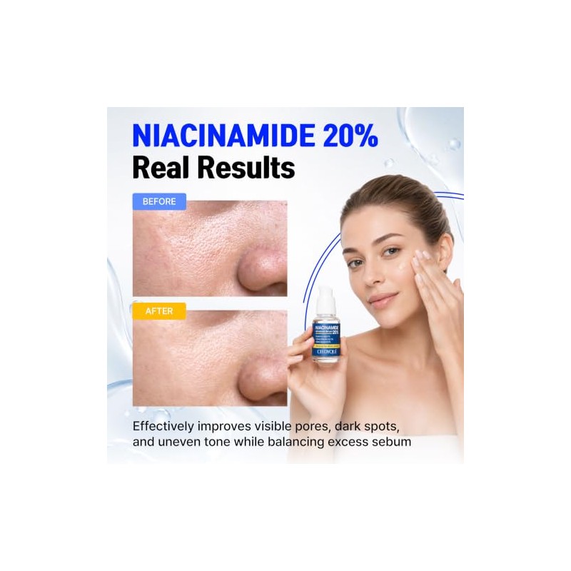 CELDYQUE- 𝙄𝙉𝙏𝙀𝙉𝙎𝙀 20% 𝙉𝙄𝙉𝙼𝙈𝙄𝙉𝙀𝙎: Fortalece la barrera cutánea, reduce visiblemente