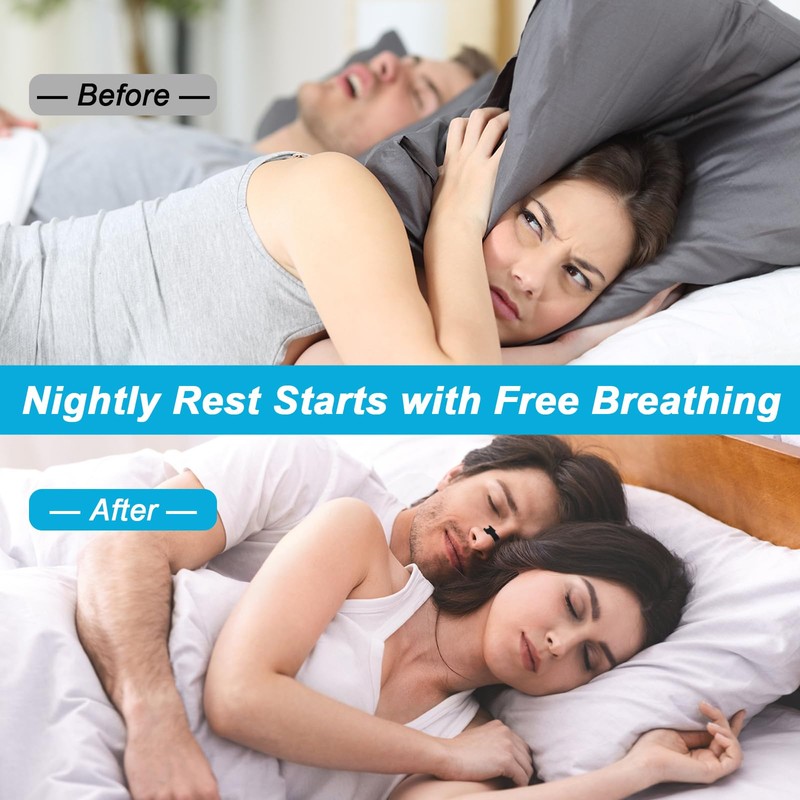 Belviorante® Parches nasales negros – Pack de 36 tiras nasales