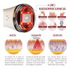 Aqua Aesthetics Mini Hifu V1.0 Radiofrecuencia Ultrasonido Rf Elimina Papada