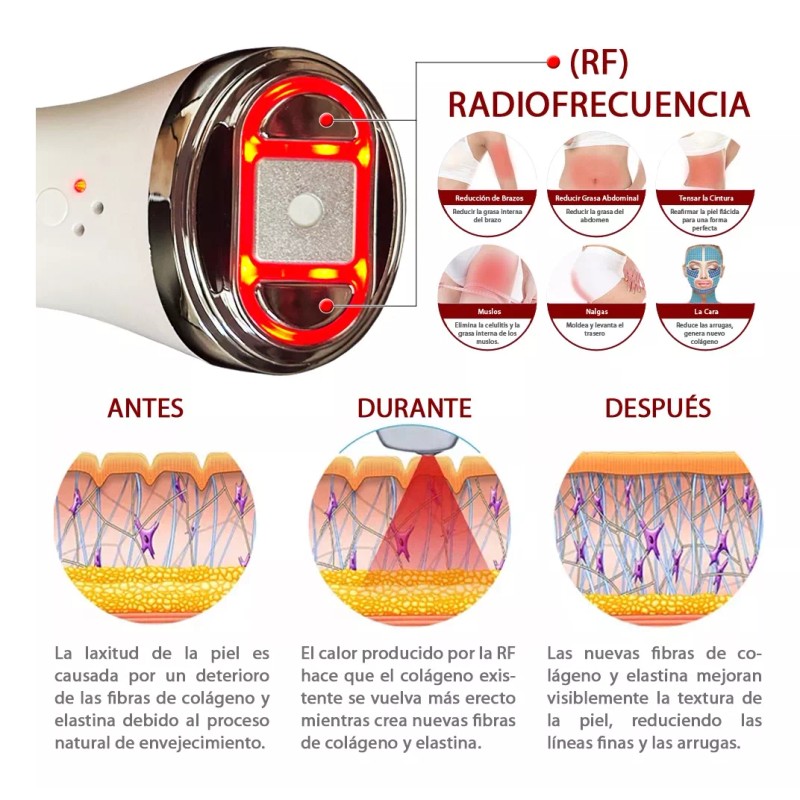 Aqua Aesthetics Mini Hifu V1.0 Radiofrecuencia Ultrasonido Rf Elimina Papada