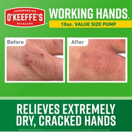O'Keeffe's Working Hands Hand Cream in a Pumpable Jar for Extreme Dryness – 10oz Pump (1 Pack) - Repairing Skincare for Cracked, Dry Hands