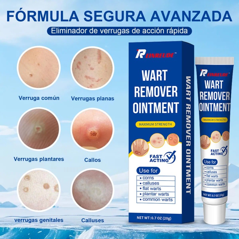 Crema Para Verrugas Elimina Eficazmente Y Cuida La Piel 20g